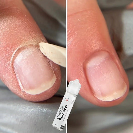 NAILSOFTHEDAY Nagelhautentferner – regenerierender Nagelhautentferner für Maniküre und Pediküre (mit Urea), 60 ml